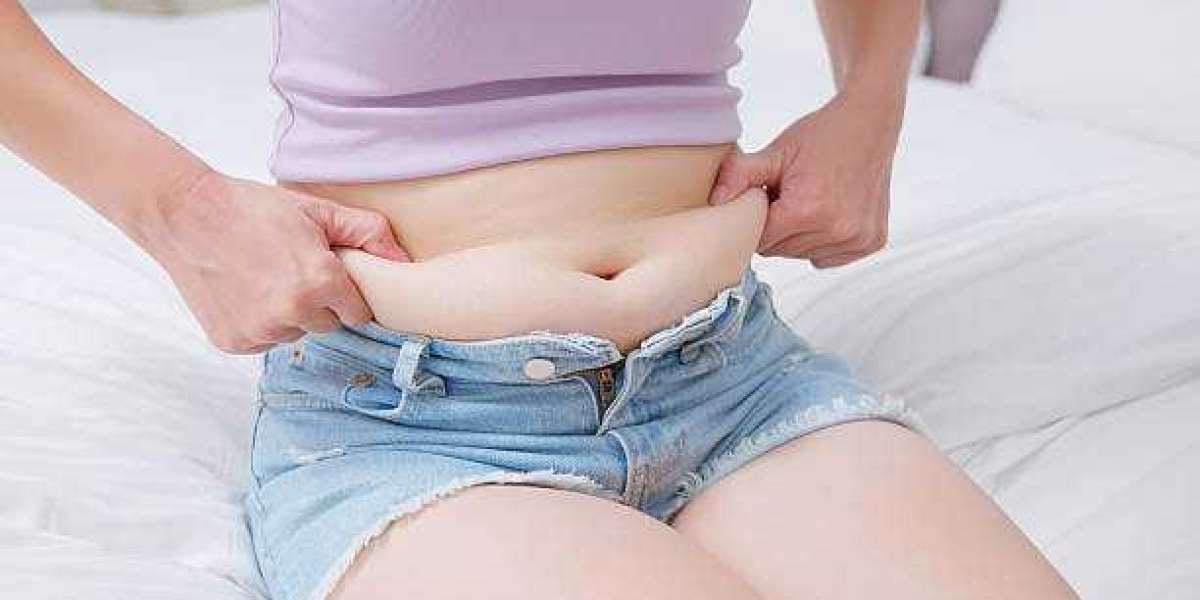 Liposuction in Riyadh: Myths and Facts – Clearing the Confusion