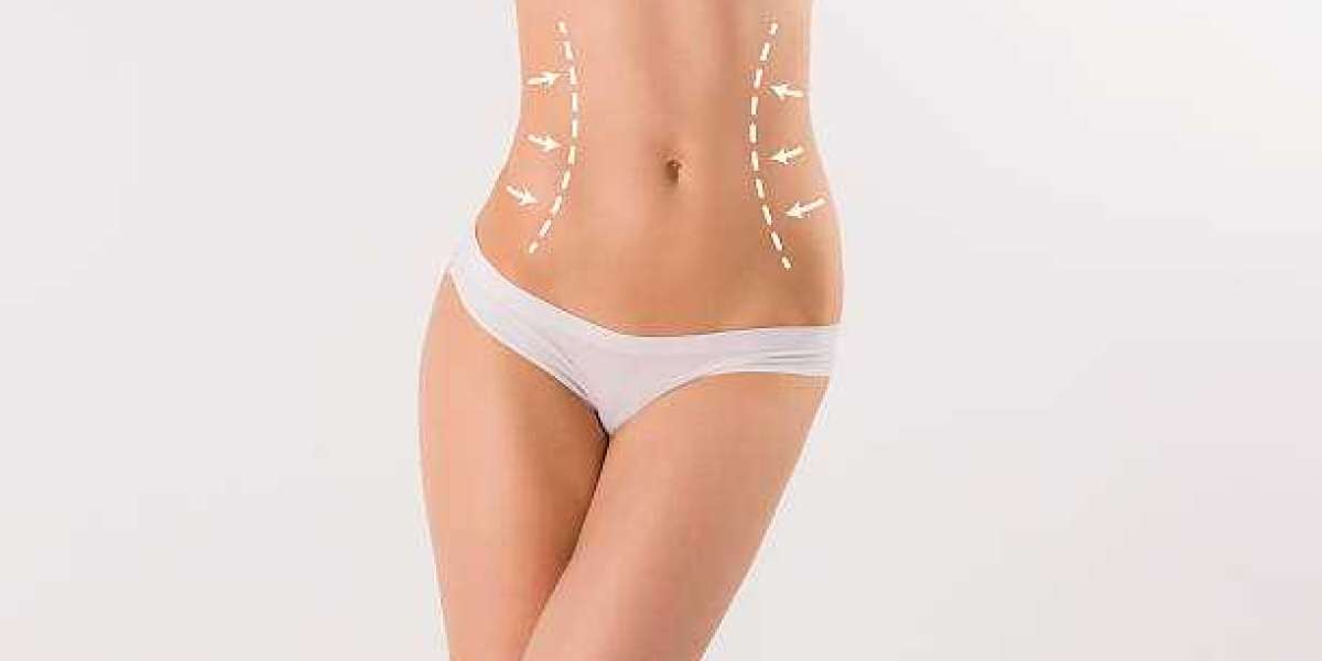 Body Sculpting Procedure for a More Sculpted Body Profile
